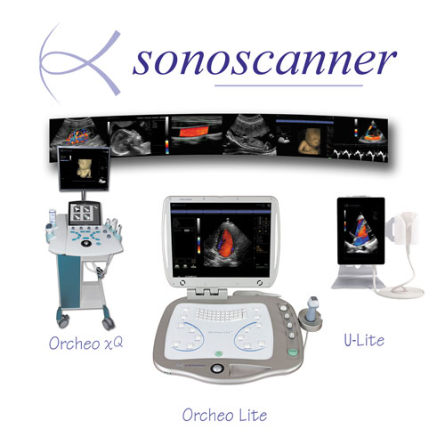 Sonoscanner